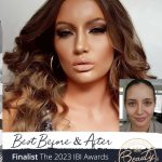 Best Before & After
