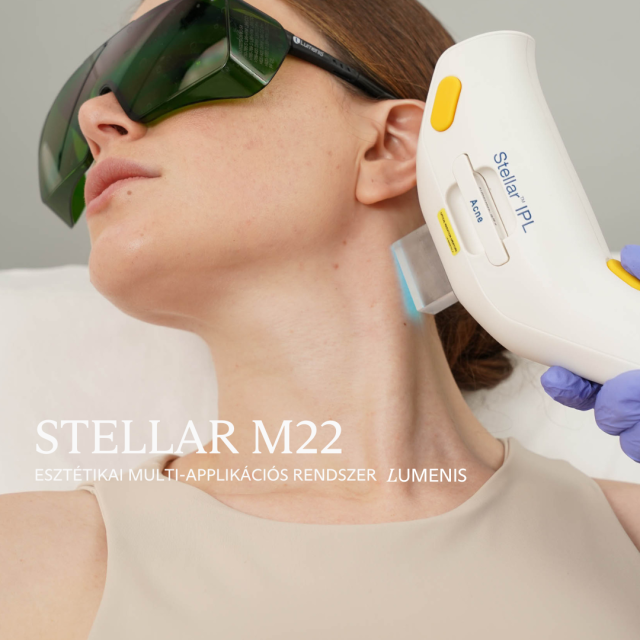 Stellar M22 Kezelés Közben