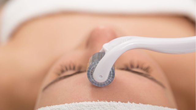 Mezoterapia