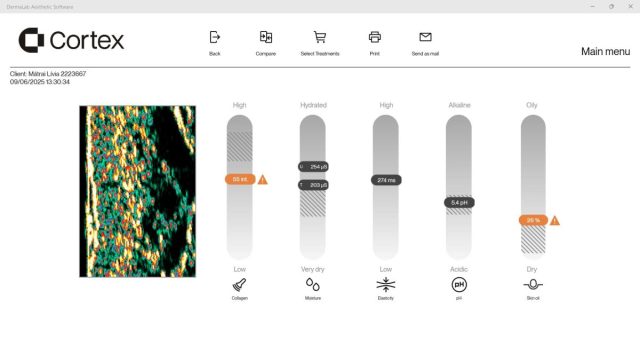 2. Az Otthonápolás és A 3 Alkalmas Swich Kúra Ztán Lcase Study 1 Right After 3 Swich Treatments + Home Care