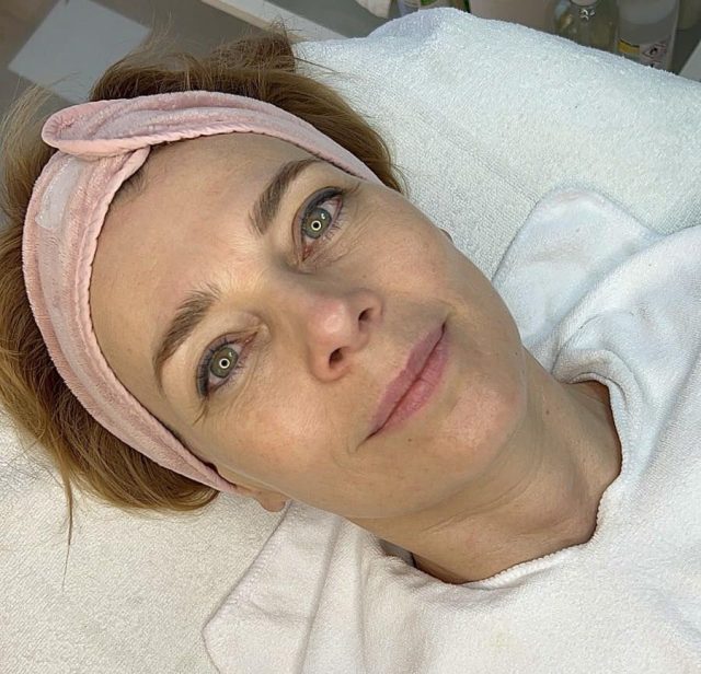 ElŐtte Fotó Bartus Márta Beauty Group