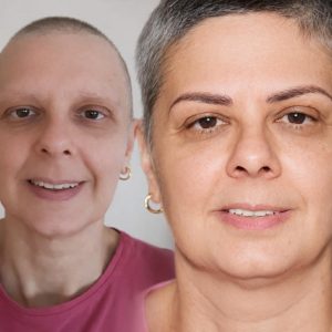 Szemöldöktetoválás Egy Mosolyért