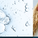 Acne 1024x417