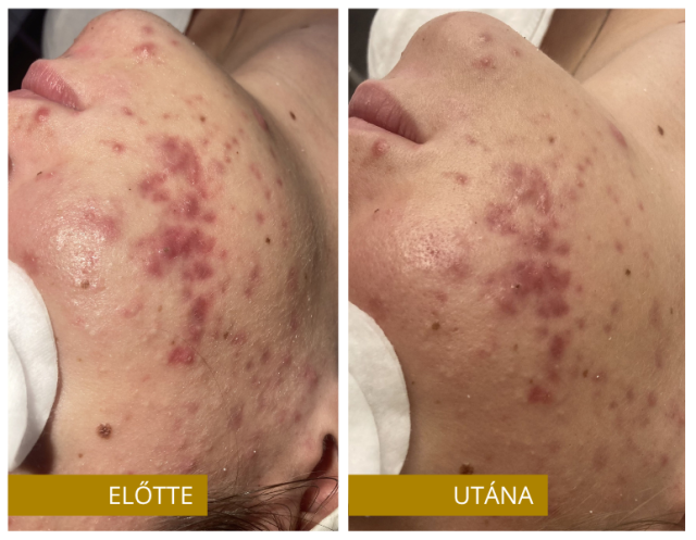 Előtte (1)